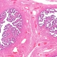 Fallopian Tube miscroscopy with H&E stain